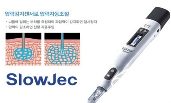 무통마취 시스템 – 가글마취, 도포마취, 무통마취기